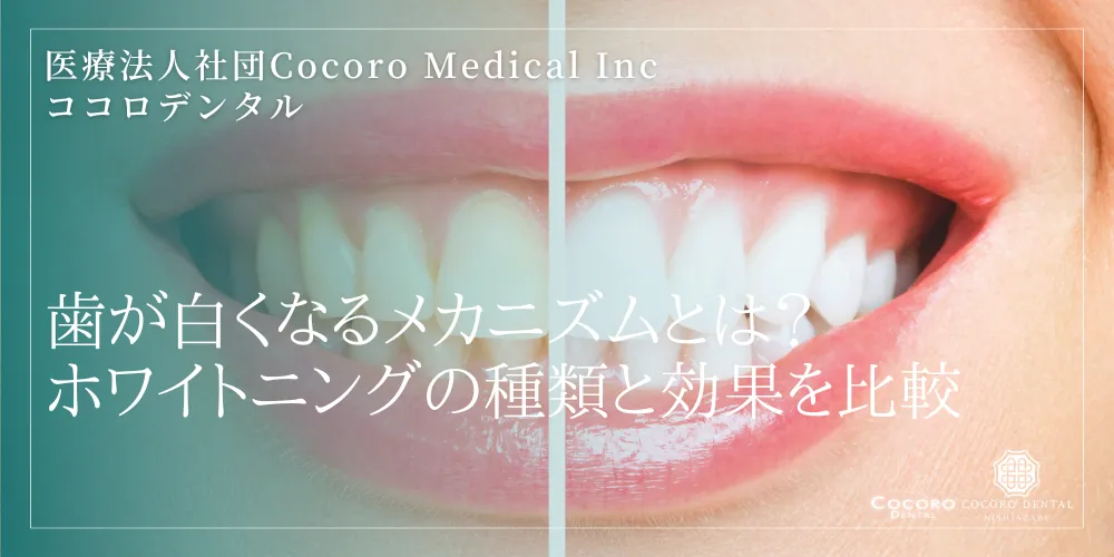 歯が白くなるメカニズムとは？ホワイトニングの種類と効果を比較